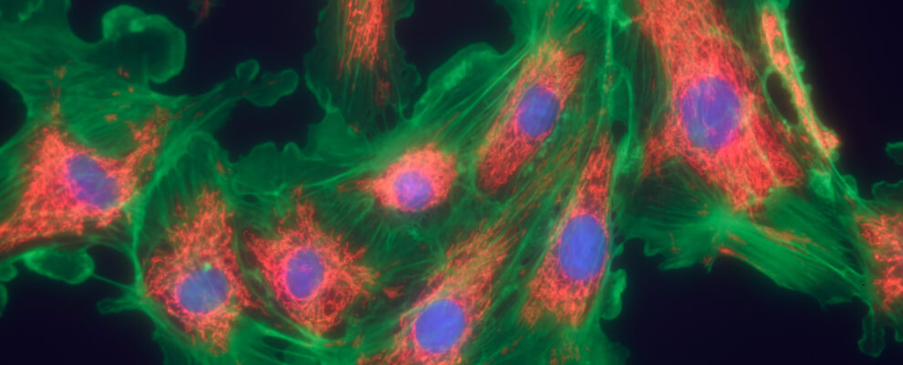 Cellular effects of psilocin on human fibroblasts